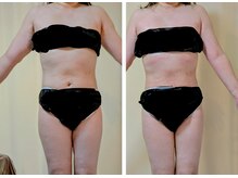 ひぺりかむ/【Day】土台作り《碁》4回目