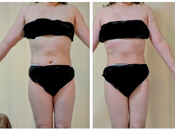 ひぺりかむ/【Day】土台作り《碁》4回目