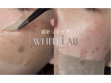 ベル(BELLE)の雰囲気（毛穴洗浄/ホワイトラボ/レモンボトル/エステ/脱毛/メンズ/痩身）