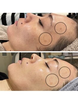 エードット(A.)/VOSサロンケア