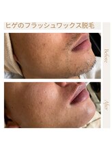 オフオルファヴォリ(OF Olu:Favori)/【フラッシュワックス脱毛】