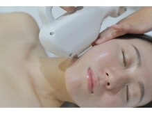 ラボーテ/顔脱毛は便利な都度払い可