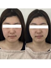 ヴェルシック(Belchic)/【誰が見ても変化は一目瞭然】