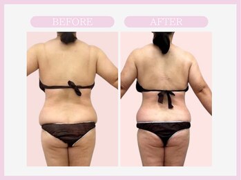 スリムライン 仙台店(The Slim Line)/before→after