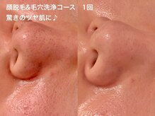 【肌に優しい＆高効果な毛穴洗浄】丁寧な工程で汚れを浮かせます