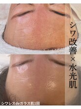 セレニア ボーテ(Selenia Beaute)/