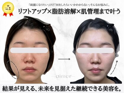 エメ(aimer)の写真