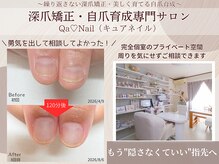 キュアネイル(Qa Nail)