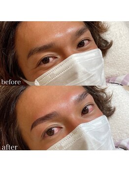 ダリ(Dali)/メンズハリウッドブロウリフト