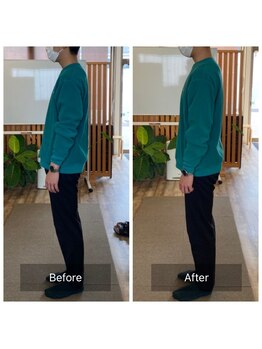 いがらし整体院/反り腰改善◎