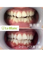 ルブラン 奈良店(Le Blanc)/遠方のお客様♪