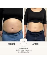 オーシャン整骨院(OCEAN整骨院)/６ヶ月ダイエットコース