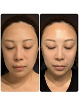 トリニティスペース(TrinitySpace)/レモンボトルビフォーアフター