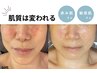 【敏感肌/赤み肌さんの肌質改善】フェイシャルケア90分