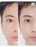 【再来】男性☆大人気♪ハリウッドブロウリフト(眉まわりのワックス脱毛込み)