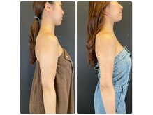 エステアンドヘアーサロン アルテ 札幌