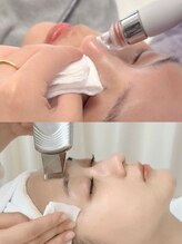 ジョイセルフ 新横浜店(JOY Self)/フェイシャル