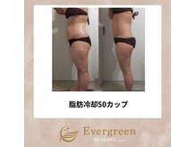 リハーツ(RE;heartz)の雰囲気（脂肪冷却★都度払いで通いやすさ◎驚きのダイエット方法♪痩身★）