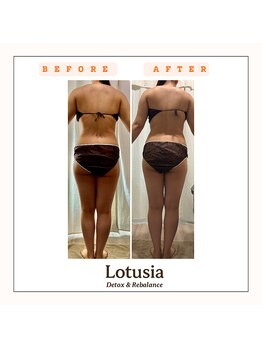 ルトゥーシア(Lotusia)/全身　before→after