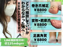 爪のいろは