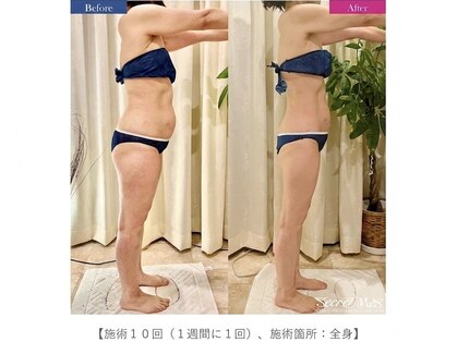 エキュレ ジャーニー トゥ マイ トータル ビューティー(equrer)の写真