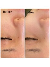 ラシック(Rachic)/