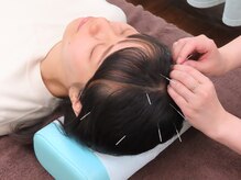 しんのう鍼灸院/ドライヘッド鍼