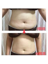 トロイカ 天王寺店(troika)/産後ダイエット10回/30代後半