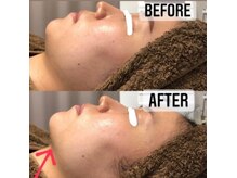 エム(M)/二重顎・フェイスライン