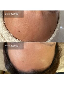 グレイス(Grace)/plasma3回目