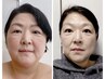【50歳からの☆たるみケア】10年前の顔へ戻したい方！　  ¥16500→10000