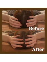 ストック(Stock)/ビフォーアフター