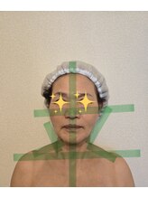 バンブー(Bamboo)/ビフォーアフターに感動　即変化