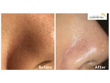 アキュレ(Acure)/ハイドロビーナス