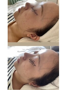 ベルミーランド 田原本/ダーマ&ラベンダーパックで☆