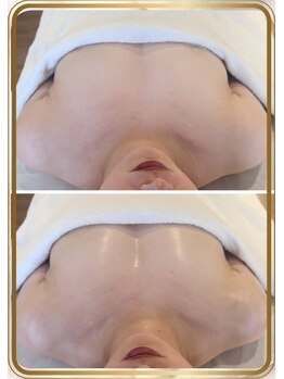 ブルーム(bluem)/流れ乳解消！！