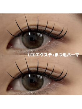 アイリー(ILY)/エクパ 140本