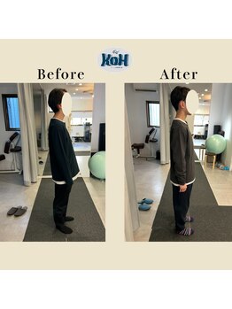 とくしま整体院 康/姿勢の変化