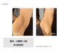 【都城脱毛】痛みに弱い方も◎小中高生・男女OKの美肌ワキ脱毛 ¥1,500