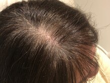 ビースタイル(BE STYLE)/ヘアーＵＰエクステ