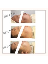 エミナル バイ ニコドット(Eminal by nico.)/繰り返す肌トラブルがお悩み