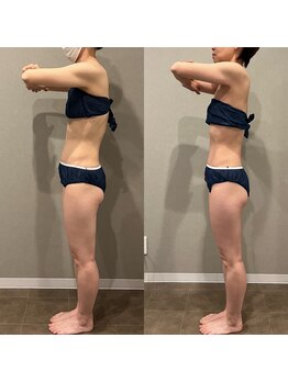 タイコボディラボ 桜山店(TAICO BODY LABO)/猫背矯正+小顔矯正