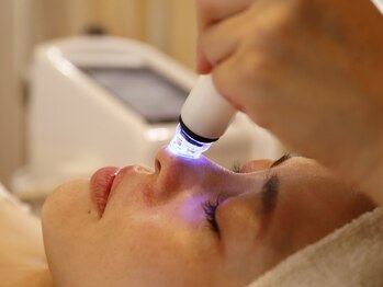 イヴ(Yves)の写真/長年のお悩み《いちご鼻》から卒業!小顔ケアも同時にできる毛穴洗浄¥8000♪お肌管理は当店にお任せ◎