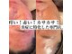 アーブル(Agreable)の写真