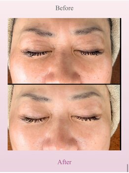 アディス 心斎橋(ADISE)/