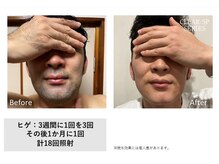 ザ エッセンシャル 碧南(THE Essential)/オーダーメイド脱毛