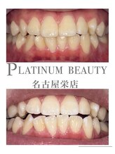 プラチナムビューティー 名古屋栄本店(PLATINUM BEAUTY)/お客様Before After