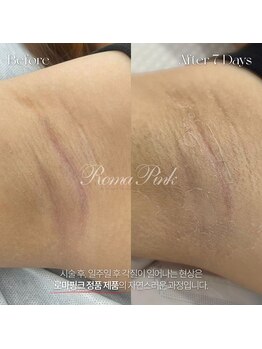 ヤエシーファイブクリニック(YAE C5 CLINIC)/札幌/ローマピンク