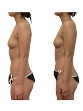 ベンザイ 梅田店(BENZAI)/ストレートネック、疲れ、肩こり