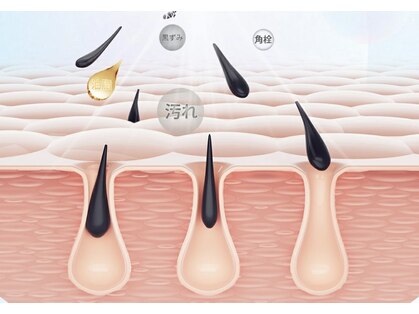 ベラ(VERA)の写真